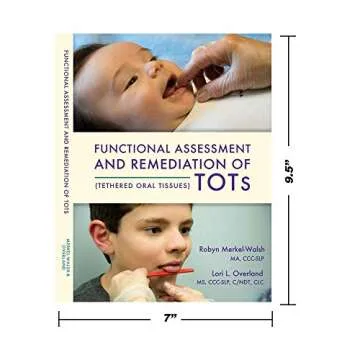 Tongue-Tied: A Guide to Tethered Oral Tissues Management