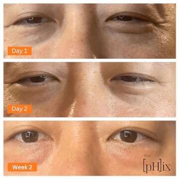 THE PHIX Caffeine Eye Cream with Hyaluronic Acid, Vitamin E, Vitamin K - Vegan (For Dark Circles Under Eyes, Face Puffiness, Facial Wrinkles, and Fine Lines)