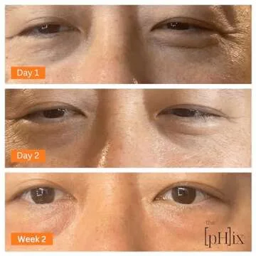 THE PHIX Caffeine Eye Cream with Hyaluronic Acid, Vitamin E, Vitamin K - Vegan (For Dark Circles Under Eyes, Face Puffiness, Facial Wrinkles, and Fine Lines)