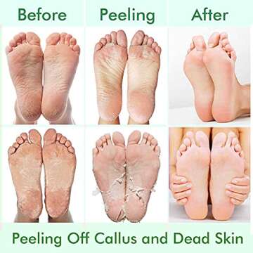 5 Pack Foot Peeling Mask,Exfoliator Peel Off Calluses Dead Skin Callus Remover,Foot Mask for Dry Cracked Feet,Foot Peel Mask for Men and Women Feet Peeling Mask for Mothers Day Gifts