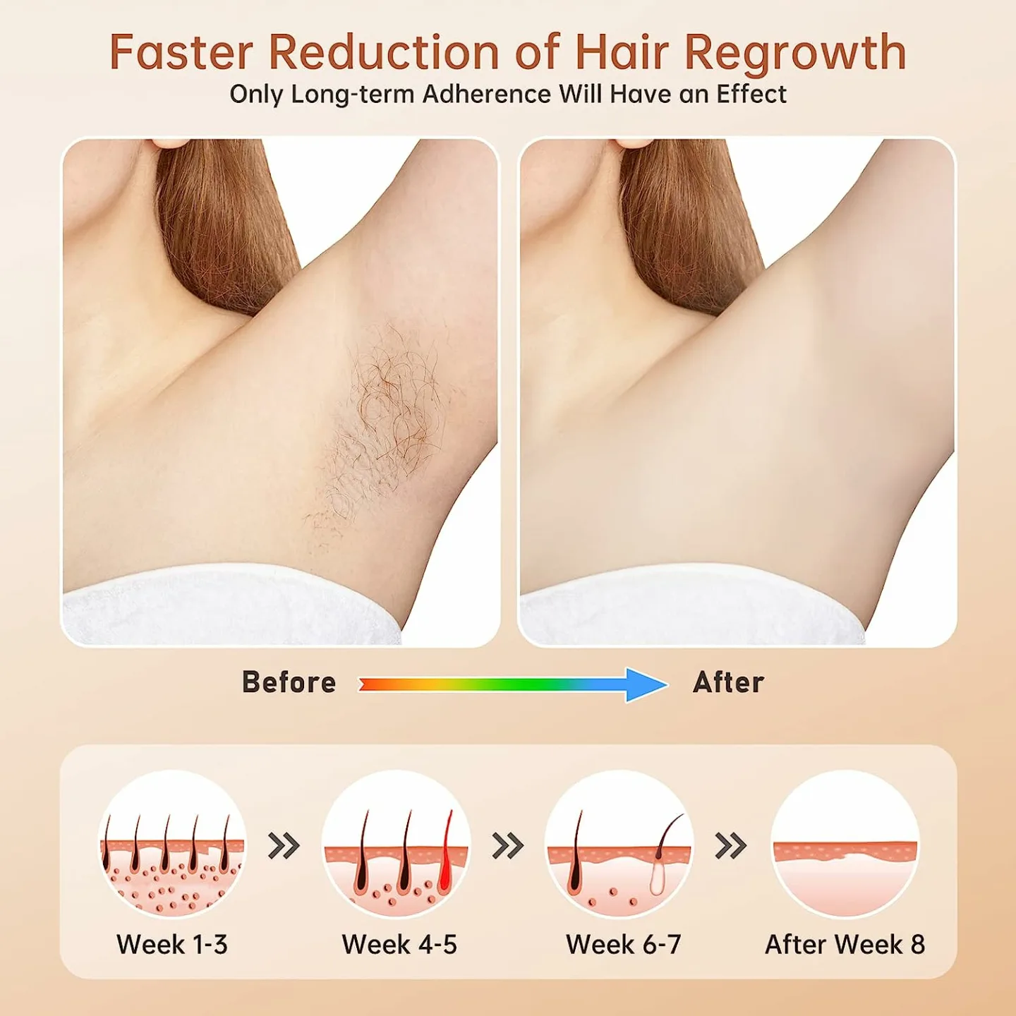 Painless At Home IPL Hair Removal Device for Women