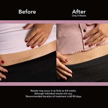 GoodSense Silicone Scar Sheets for C-section Recovery