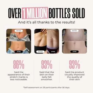 B-FLAT Belly Firming Cream for Stretch Marks and Tightening