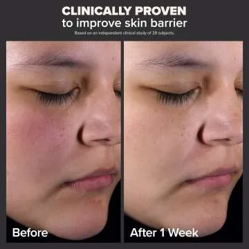 Paula's Choice 2% BHA Liquid Exfoliant Travel Size