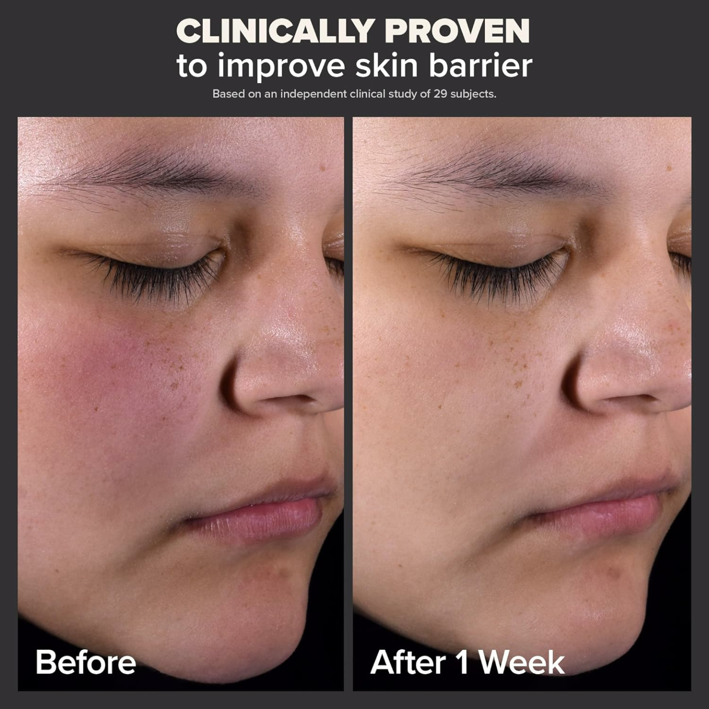 Paula's Choice 2% BHA Liquid Exfoliant Travel Size