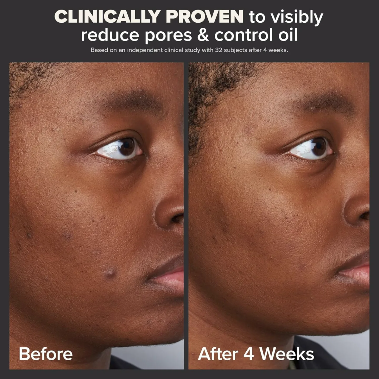 Paula's Choice 2% BHA Liquid Exfoliant Travel Size