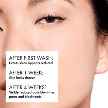 Vichy Normaderm Daily Acne Face Wash, 0.5% Salicylic Acid Cleanser, Gel Cleanser For Oily Skin, Remo...