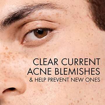 Vichy Normaderm Daily Acne Face Wash, 0.5% Salicylic Acid Cleanser, Gel Cleanser For Oily Skin, Removes Excess Oil, Dirt & Clogged Pores, Oil Free Acne Wash, Soap & Sulfate Free, Non-Drying