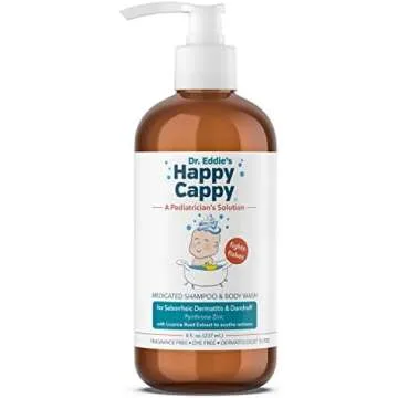 Cradle cap