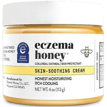 Grey’s Eczema