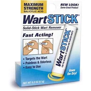 Wart Treatments