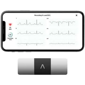 KardiaMobile Devices for Tracking Atrial Fibrillation