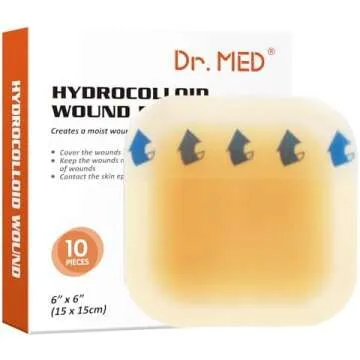 First Aid - How I treated my burn