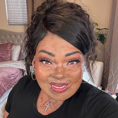 Burned Beauty 2018 🦋 Profile