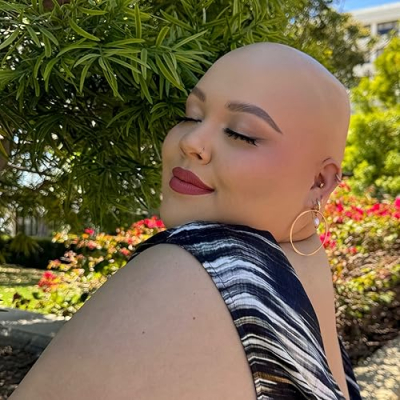 Chiara aka BaldieChi Profile